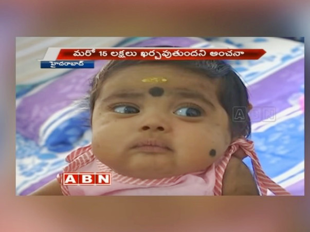 Help Siva Save His 4-Month-Old Baby Girl From HLH Disease