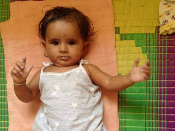 Fund Raising For Congenital Heart Surgery Of Child