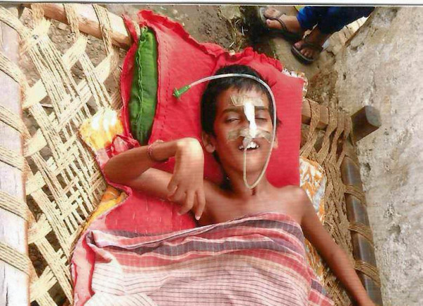 Help 9-year-old Suman fight Japanese Encephalitis & Brain Damage!