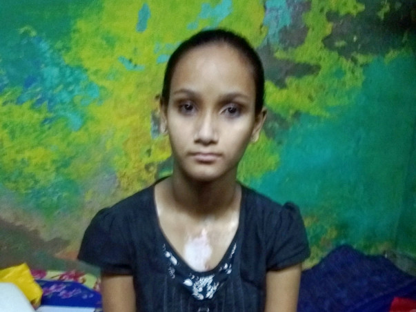 Raise Your Hands To Help Rohini (13yrs) Suffering From Heart Disease