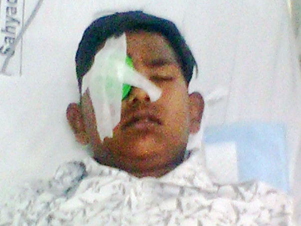 Help Abhay Undergo Removal Of Foreign Object From His Eye's