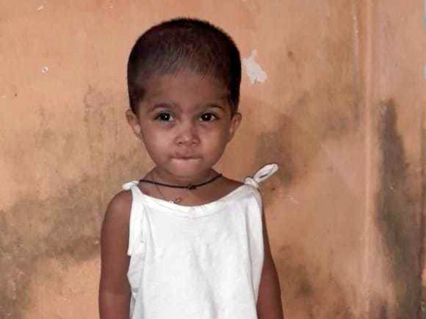 Help My Daughter Undergo Heart Surgery