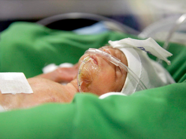 Only 6 Days Old, This Baby Is Not Strong Enough To Breathe On His Own