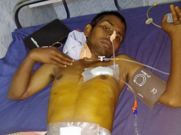 Samba Siva Need emergency surgery