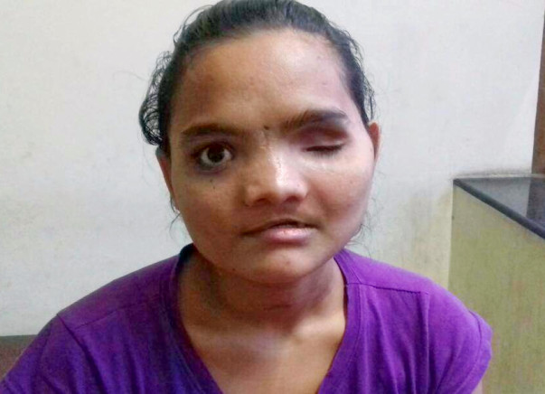 Help Vaishali get an operation that helps her eat and see again