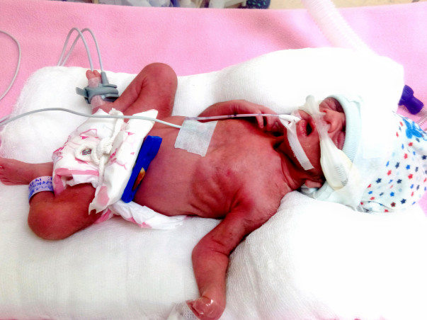 Help Save My Baby Girl
