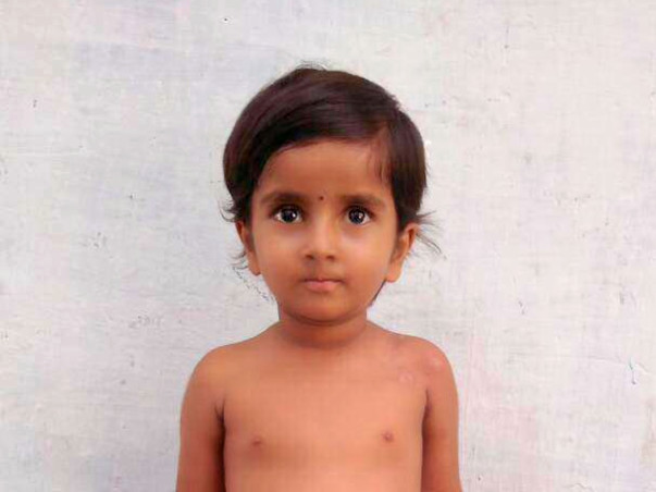 Help my daughter for liver transplantation