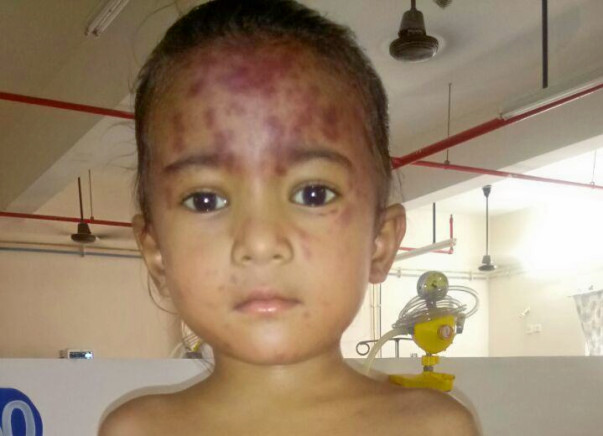 Help Gayatri, Who Needs A Bone Marrow Transplantation