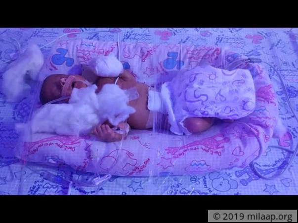 Help My Premature Twins Survive
