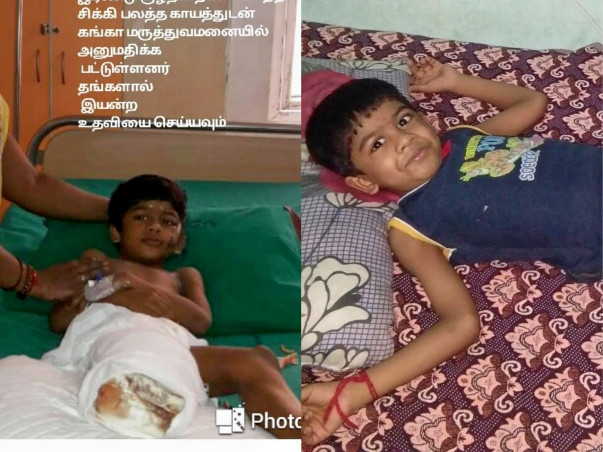 Help 6 Year Old Hari Haran Walk After His Accident.