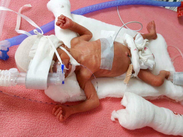 Help a new born fight a battle of life.