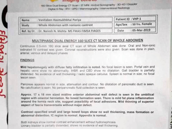 Support My Mother's Umbilical Hernia Treatment