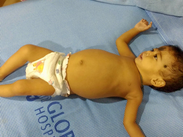 After Losing Two Babies, This Family Is Desperate To Save Their Child