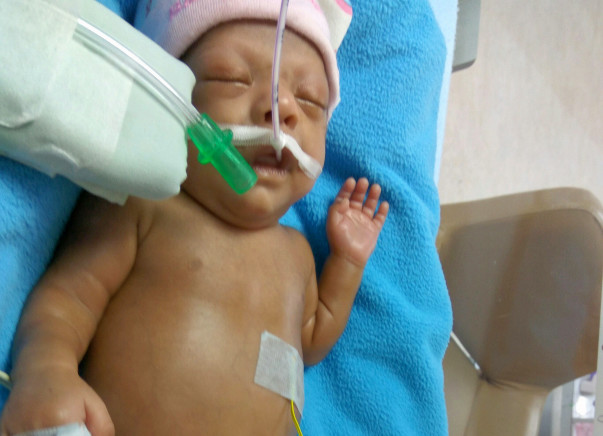 Help baby's Fight in NICU