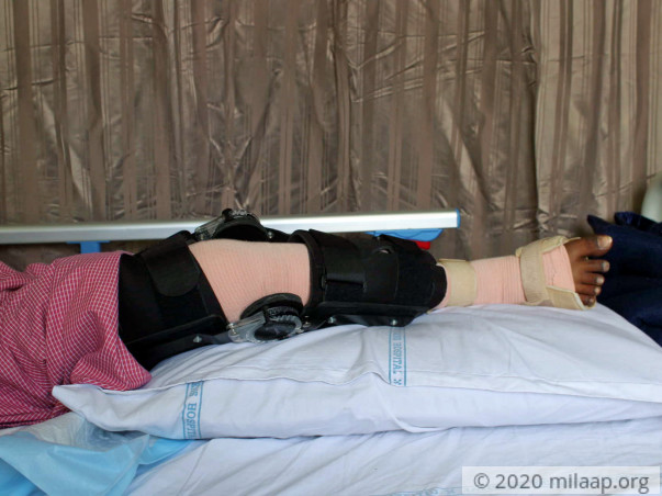 Help V Prabhavathi Recover From Synovinal Sarcoma Of Right Knee