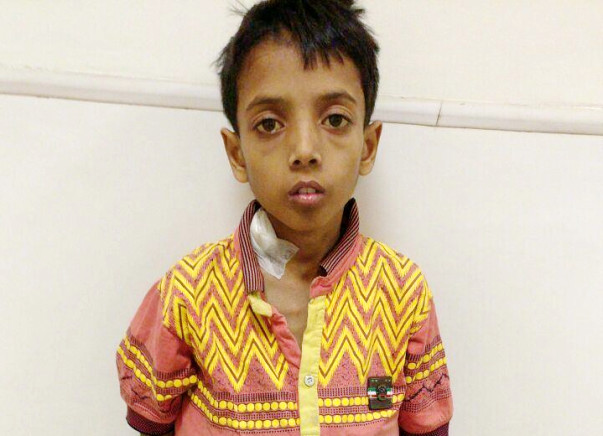 Help 9-year-old Vishi undergo a surgery to stay alive