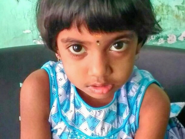Help 3-year-old Hashini Fight Blood Cancer