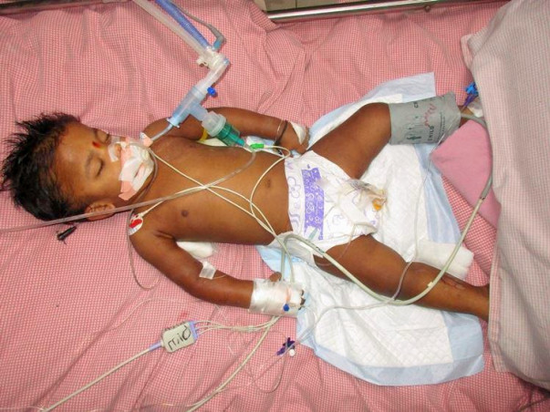 Help My 2-Year-Old Fight Acute Encephalopathy
