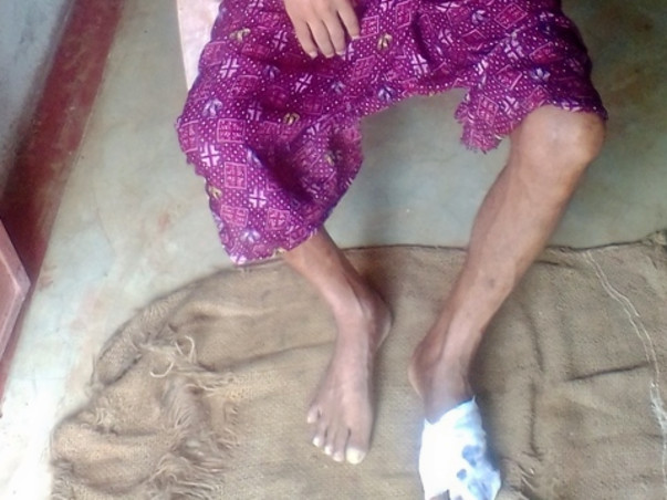Support My Father Undergo Medical Treatment For His Infected Foot.