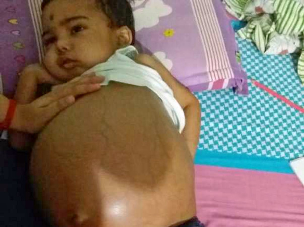 Help Save Little Prabal.