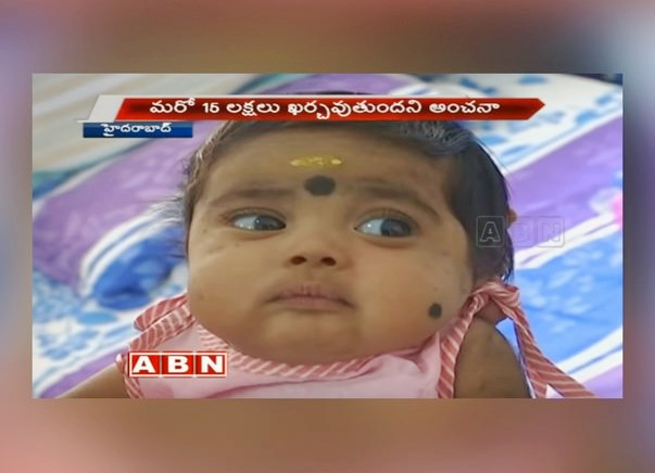 Help Siva Save His 4-Month-Old Baby Girl From HLH Disease