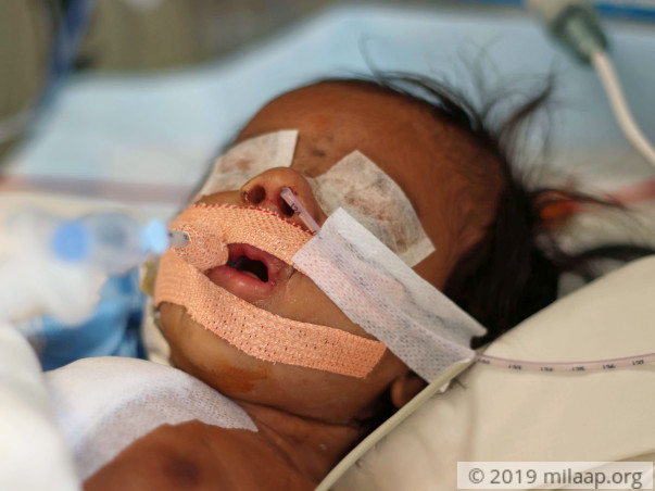 Farmer's 2-Month-Old Can Fight Heart Disease With Your Help