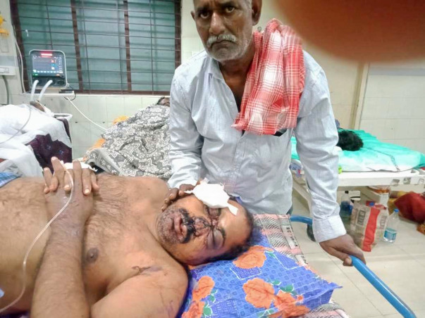 Help Sateesh Podila Undergo Plastic Surgery