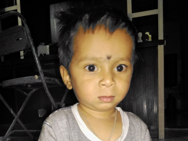 Help My Son Undergo Surgery for Cochlear Implantation