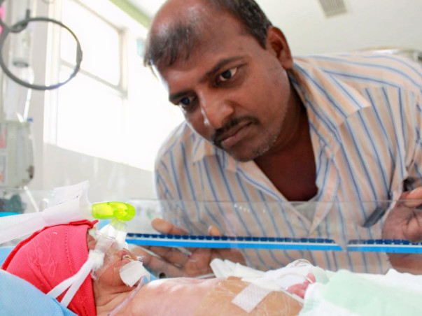 7-Day-Old Twins Need Help To Be Able To Breathe On Their Own And Live