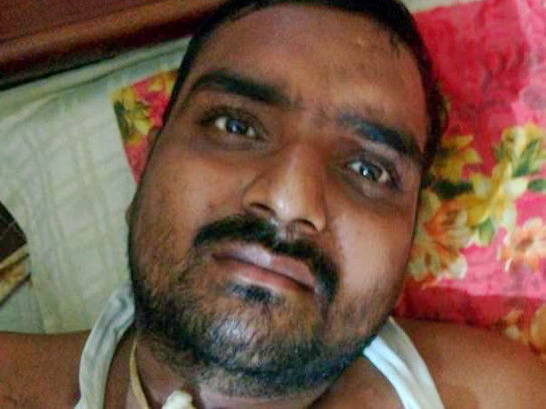 Help Sanjay Undergo Baloon Sinuplasty Treatment