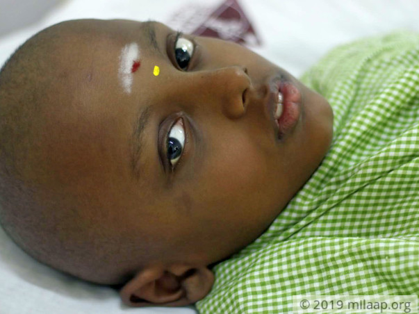 Help Mugilesh Recover From Acute Lumphoblastic Leukemia