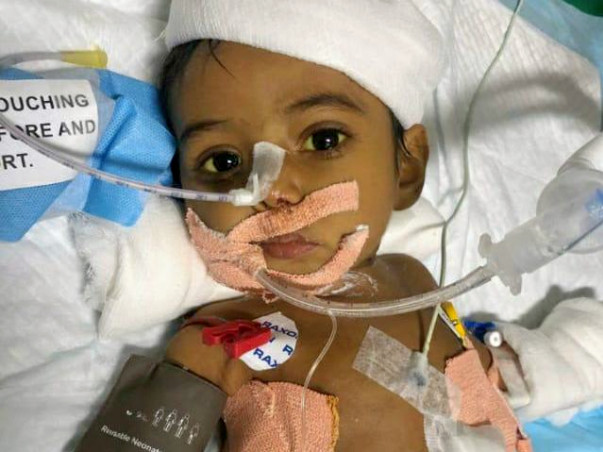 6 months old Piyush Kundu needs your help fight Biliary Atresia