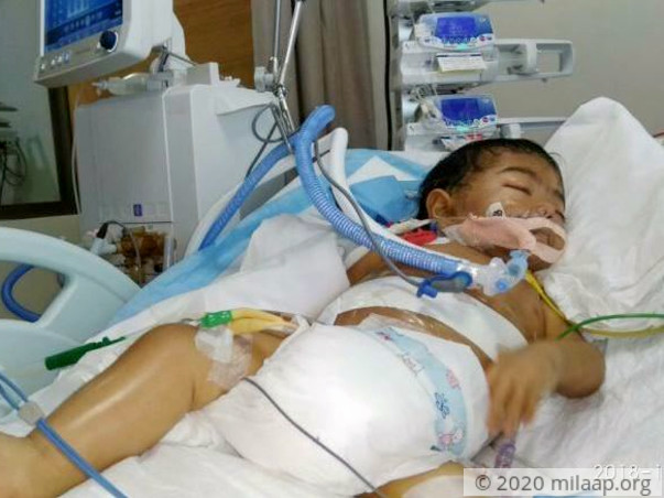 At 10 Months, Aizen's Survival Depends On An Urgent Liver Transplant
