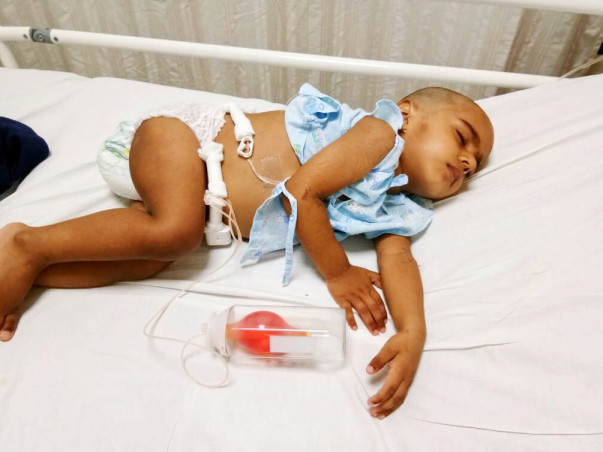 2-year-old Aniketh urgently needs your help to fight Liver Cancer