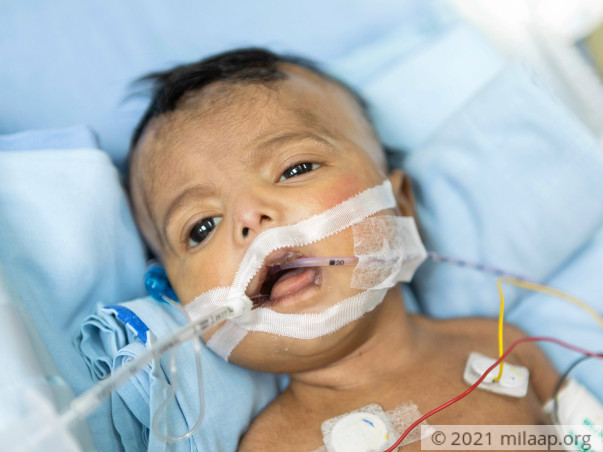 Severe Infection Will Spread From Baby’s Intestines To Her Entire Body