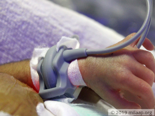 12 days old baby needs your help to survive