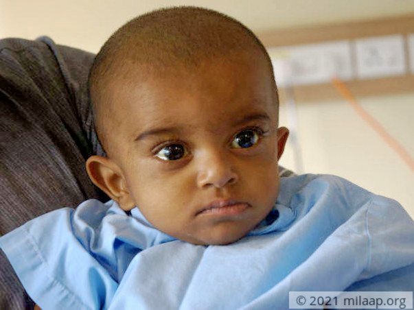 This 8-month-old needs a liver transplant to survive