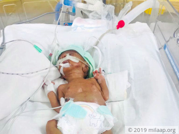 baby of manju devi neonatal sepsis