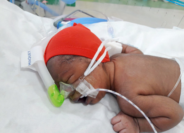 New Born Baby Needs Your Support To Live