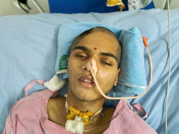 18-Year-Old's Skull is Partly Removed After Accident, Needs Surgery