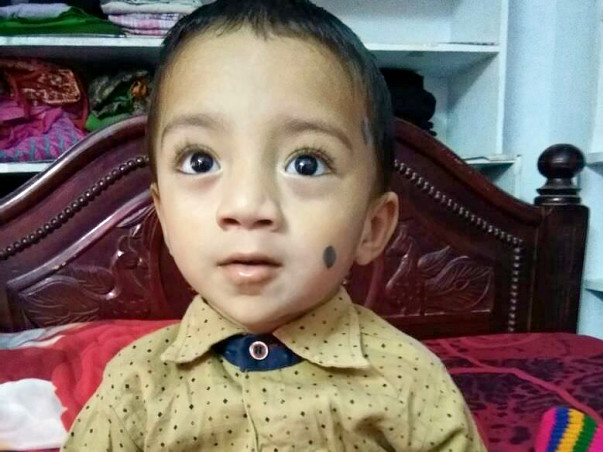 Help required to My Friend for his son's surgery