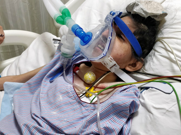 Urgent Funds Needed For Our Angel Kajal - Cerebral Palsy Child