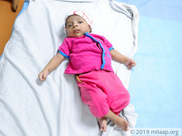 Help Baby Mohammed Hamza Undergo A Cardiac Surgery