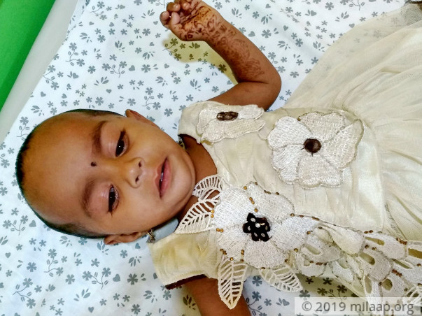 This Baby Has A Rare Birth Defect That Is Killing Her From Inside