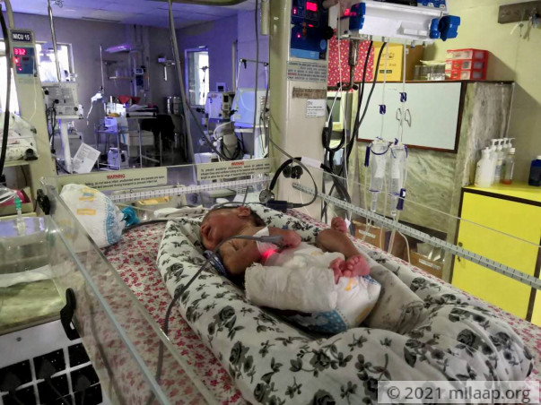 Baby Of Sharmina Ahmed needs your help to survive