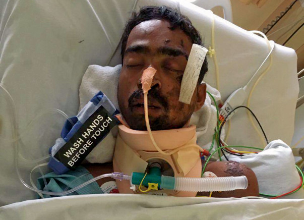 Help Accident Victim, Gautam Kamble Undergo A Crucial Surgery