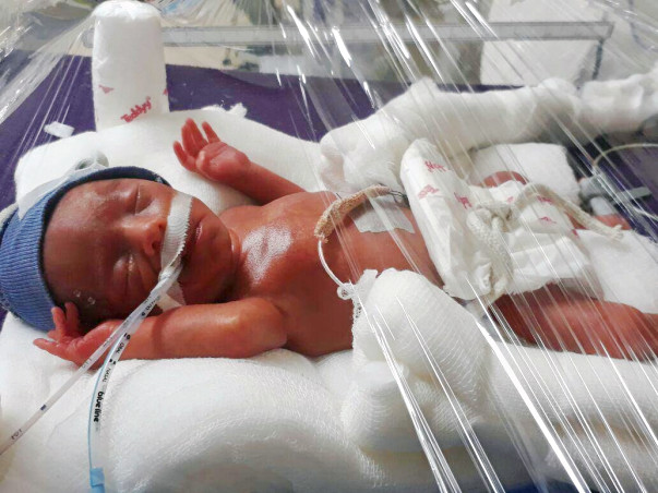 Please Save My One-month-old Baby Boy