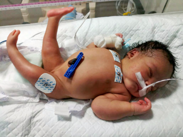 We will save her.... she’s just born!