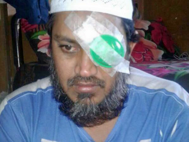 Ali is at the risk of completely losing his eyesight.