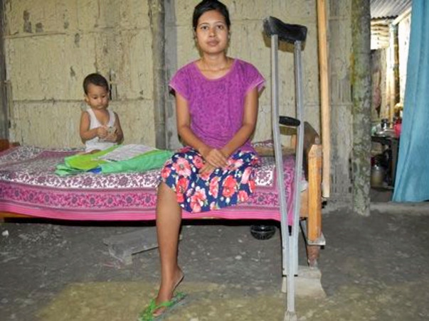 Help Jutika To Get Her Leg Back